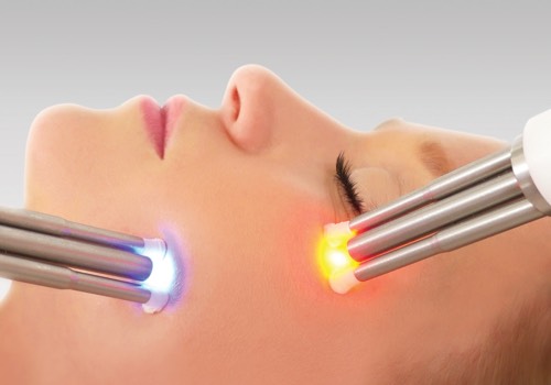 caci treatment